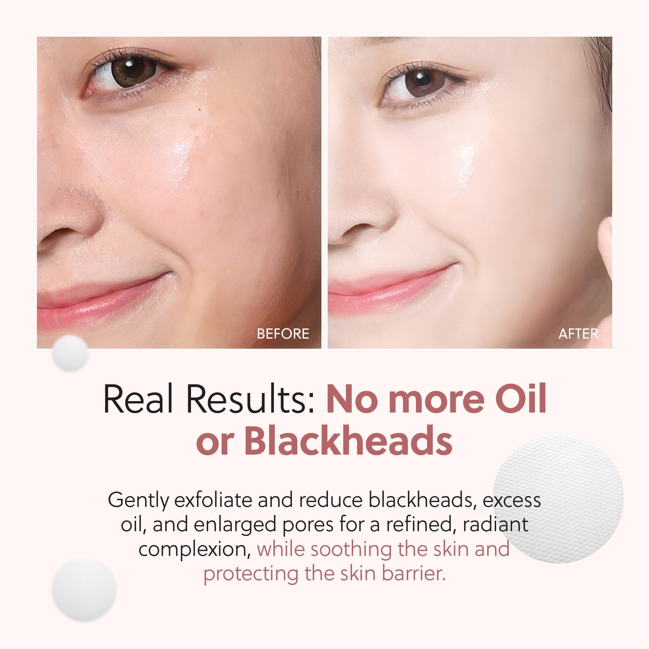 No More Pore Pads