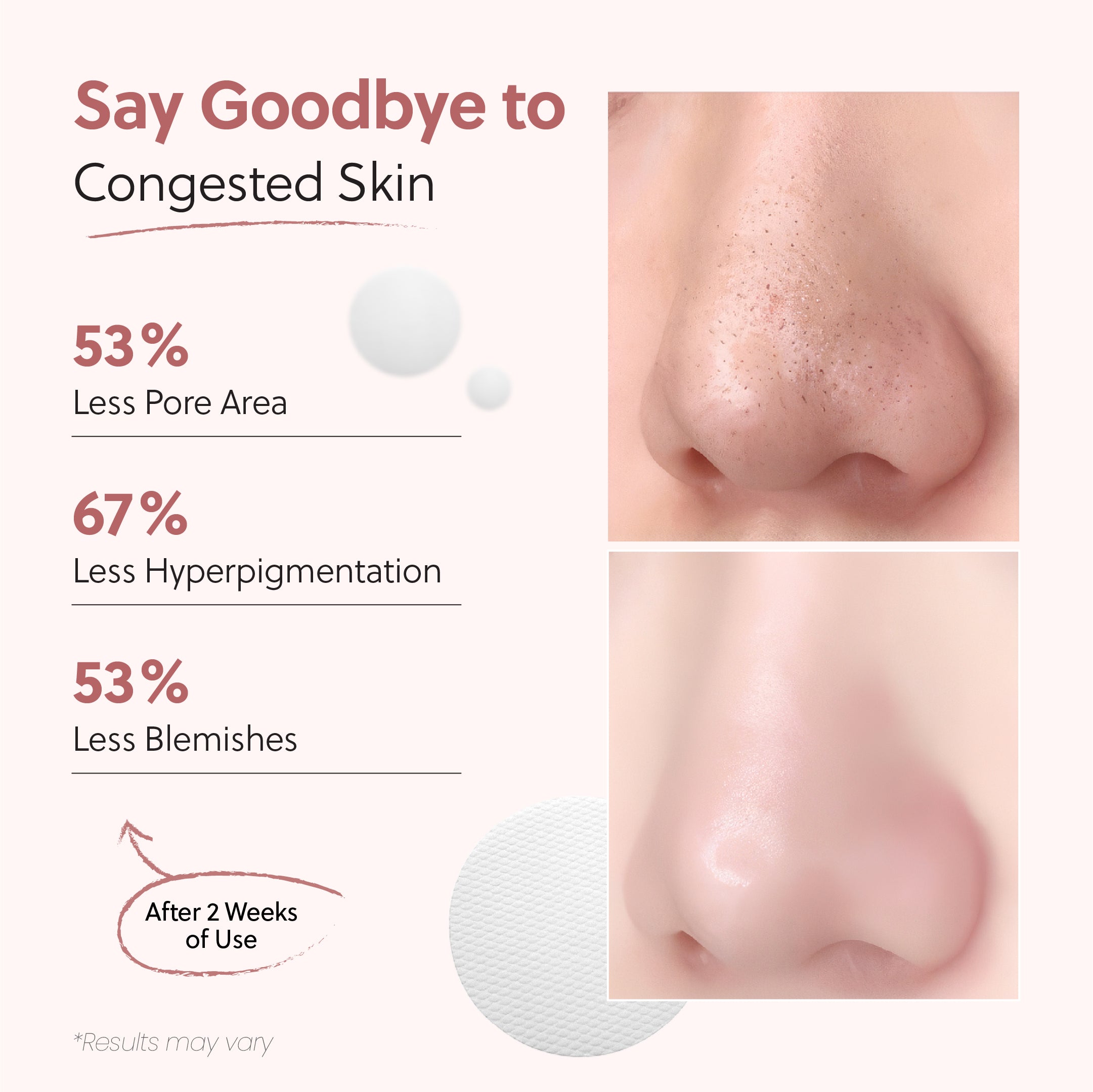 No More Pore Pads
